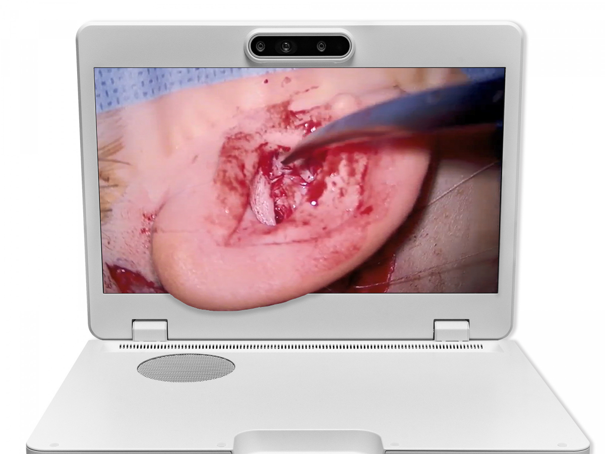 达擎之＂Heads-up 3D显微手术显示系统＂，整合4K裸眼3D显示及眼球追踪系统，具备快速追踪人眼移动位置功能，减轻医师长时间维持固定姿势的负担，让医师能有更宽广清晰的3D立体视野及更舒适的姿势来执行手术。